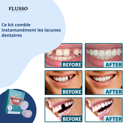 Pair Adjustable Clip-On Denture