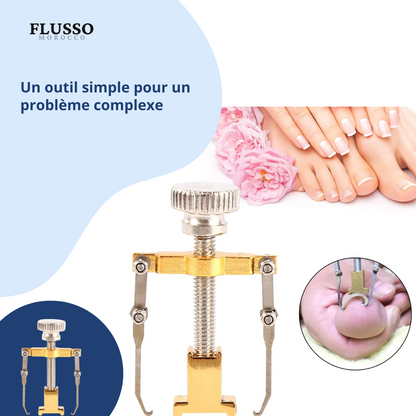 Nail Fixer™ | Correcteur d’Ongles Incarnés