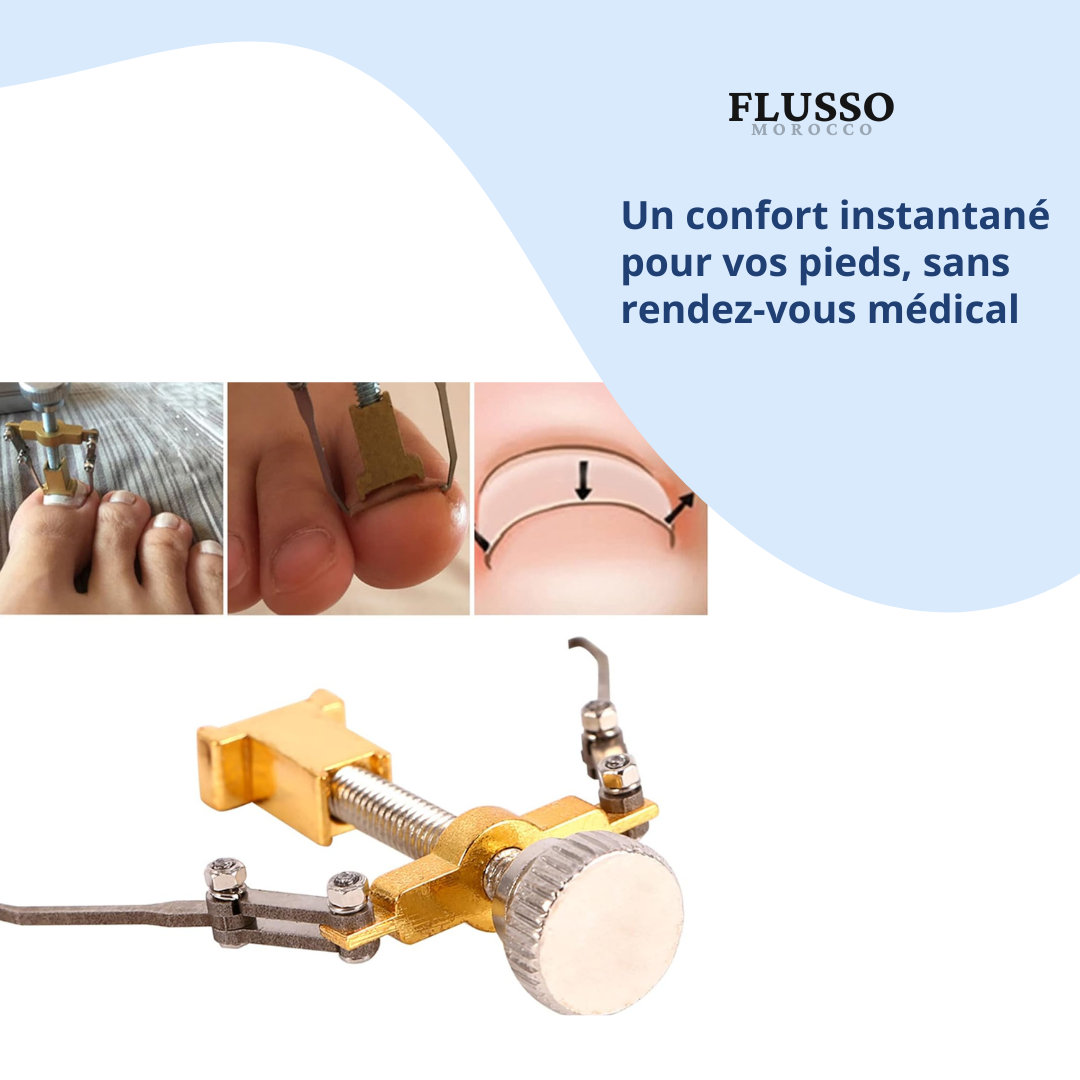 Nail Fixer™ | Correcteur d’Ongles Incarnés